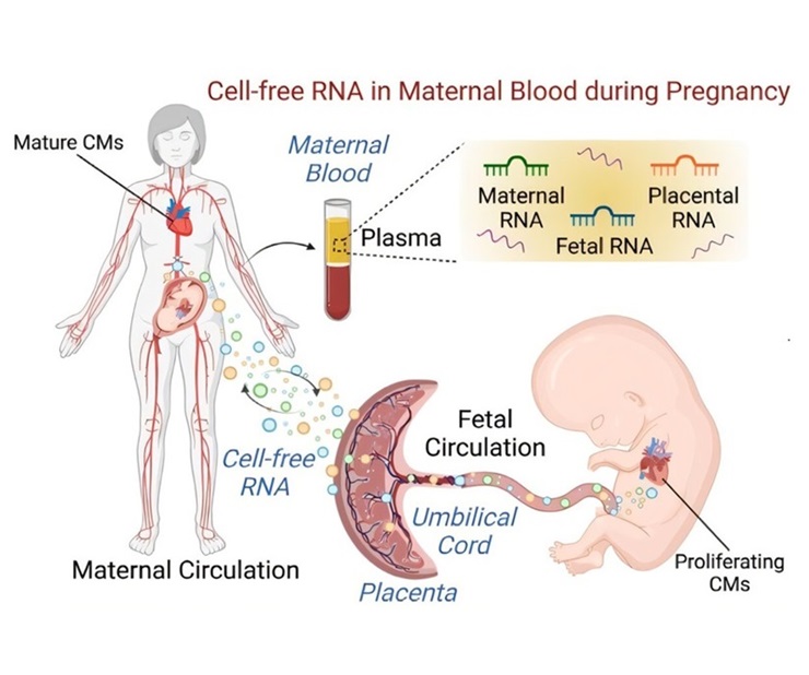 Imagen: Descripción general esquemática del descubrimiento de biomarcadores maternos utilizando ARN libre de células durante el embarazo (foto cortesía de Circulation Research (2024). DOI: 10.1161/CIRCRESAHA.124.325024)
