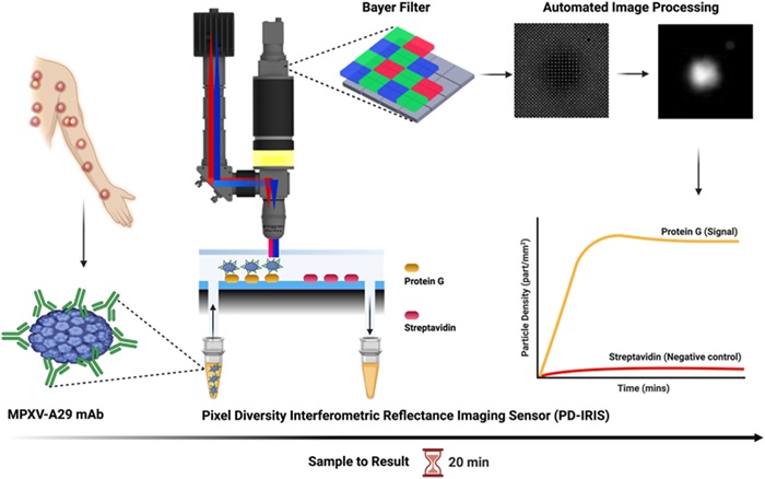 Imagen: Una prueba de punto de atención basada en biosensor óptico sin etiqueta para la detección rápida del virus de la viruela del mono (Foto cortesía de Biosensors and Bioelectronics)