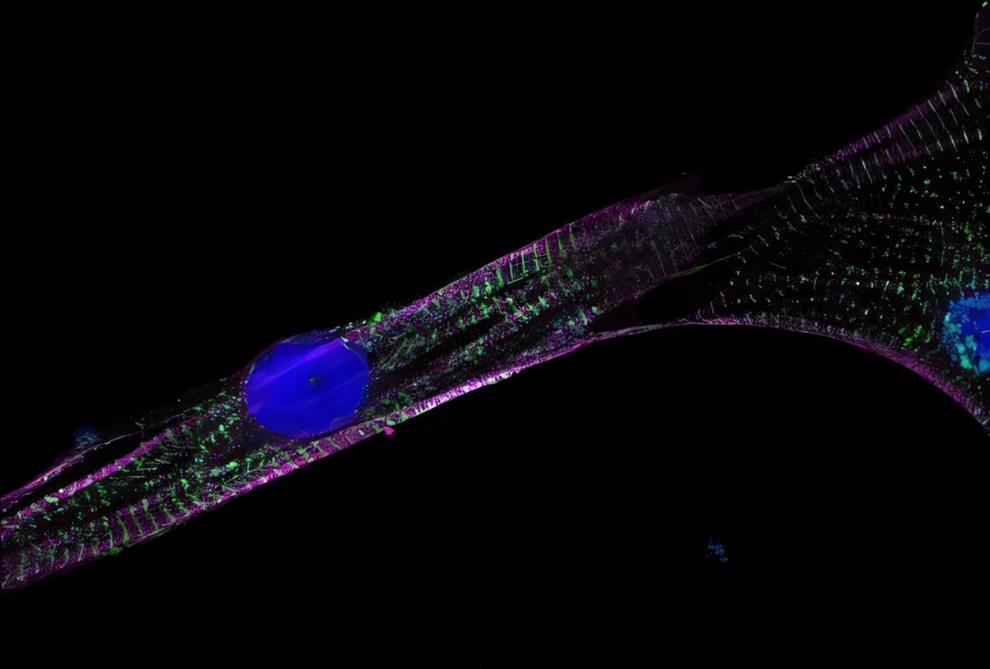 Imagen: Un sarcómero, o parte de un cardiomiocito que ayuda a las células del corazón a latir, conserva su estructura después del tratamiento con indisulam y doxorrubicina (Foto cortesía de Joseph Wu Lab/Stanford Medicine)