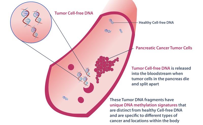 Imagen: el método genómico innovador tiene el potencial de descubrir información previamente pasada por alto (foto cortesía de Breakthrough Genomics)