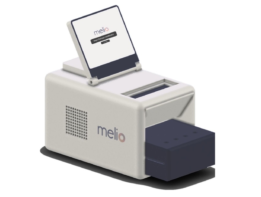 Imagen: el sistema innovador ofrece una forma más rápida de diagnosticar infecciones transmitidas por la sangre (foto cortesía de Melio)