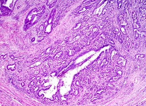 Imagen: la herramienta de IA puede buscar en imágenes de datos e histología para obtener información mucho más precisa sobre la efectividad del tratamiento del cáncer (foto cortesía de Shutterstock)