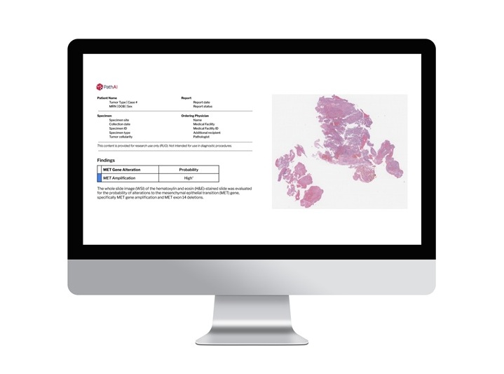 Imagen: Discovery implementará los productos AISight IMS, ArtifactDetect y TumorDetect de PathAI a nivel mundial en todo su negocio de bioespecímenes (foto cortesía de PathAI)