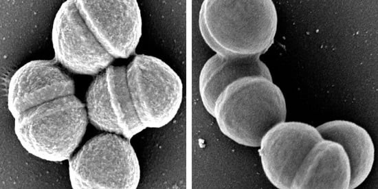 Imagen: los estudios tienen el potencial de mejorar significativamente el uso seguro de antibióticos y reducir la RAM (foto cortesía de la Universidad de Deakin)