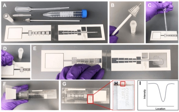 Imagen: flujo de trabajo de la prueba de papel HPV E7  (foto cortesía de Scientific Reports, DOI: 10.1038/s41598-024-79472-2)