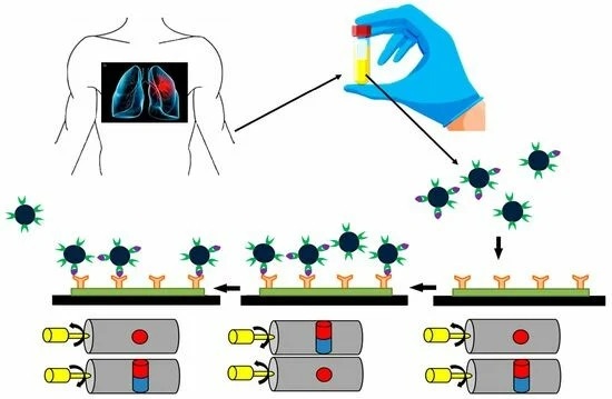 Imagen: el nuevo dispositivo de detección se ha mostrado prometedor para la detección temprana del cáncer de pulmón (foto cortesía de Biosensors, DOI: 10.3390/bios14120624)