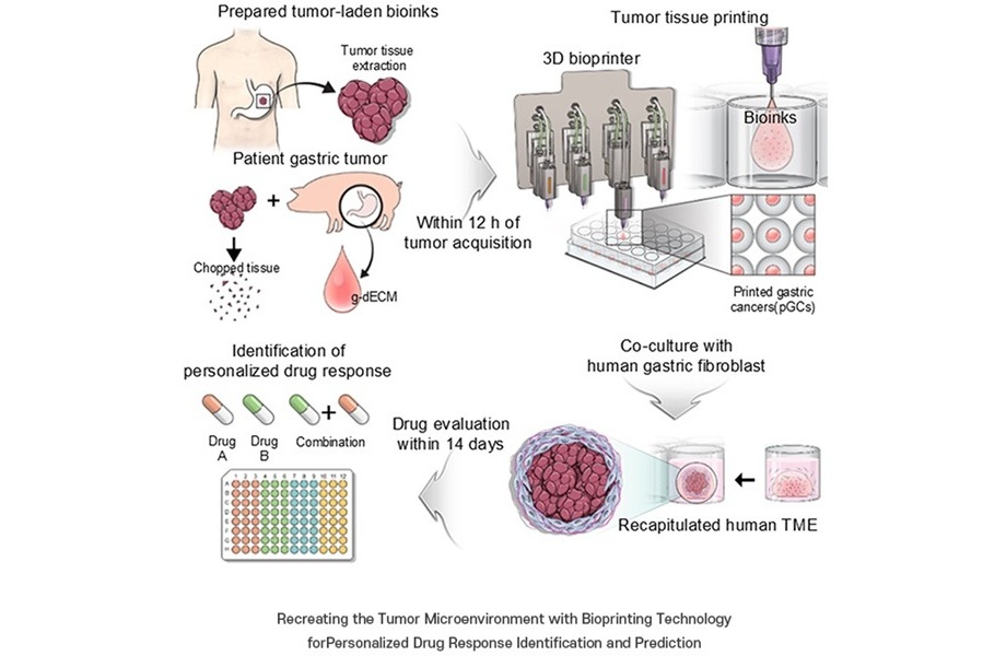 Imagen: tratamiento personalizado contra el cáncer utilizando tecnología de bioimpresión 3D (foto cortesía de POSTECH)