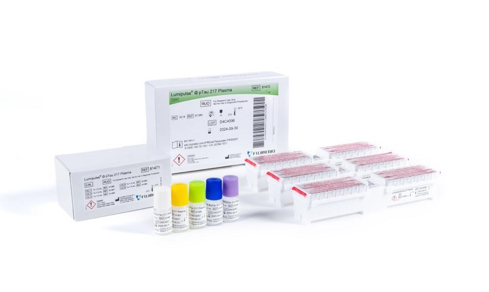 Imagen: el ensayo Lumipulse G Plasma P-Tau217 permite un mejor diagnóstico de la enfermedad de Alzheimer (foto cortesía de Fujirebio)