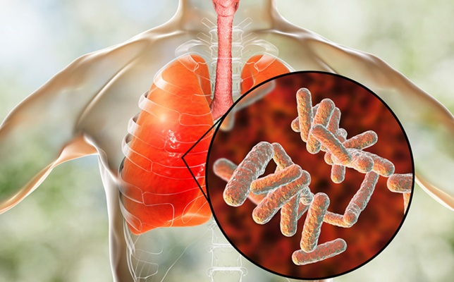 Imagen: el sistema de código de barras único permite el seguimiento de K. pneumoniae a medida que se mueve por todo el cuerpo (foto cortesía de AdobeStock)