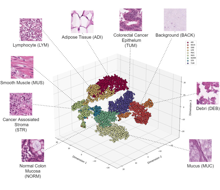 Imagen: los cuadrados son imágenes parciales representativas de las diapositivas de microscopía del cáncer, que el sistema de IA ha organizado automáticamente por su similitud (foto cortesía de la Universidad de Jyväskylä)