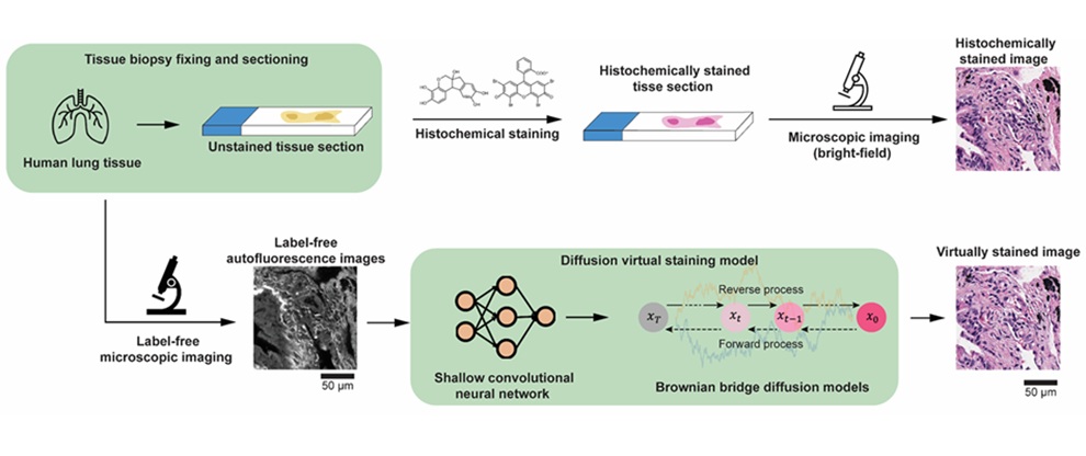 Imagen: tinción virtual con súper resolución de tejido sin etiquetas utilizando modelos de difusión (foto cortesía de Ozcan Lab/UCLA)