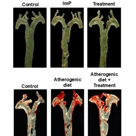 Imagen: los investigadores han identificado un metabolito producido por las bacterias intestinales como impulsor de la aterosclerosis (foto cortesía de CNIC)