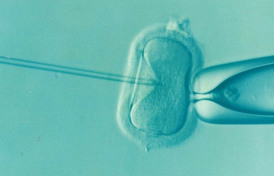 Imagen: un estudio ha encontrado que las pruebas genéticas de los embriones de FIV ayudan a las mujeres de más de 35 años a concibir más rápido (foto cortesía de DrkontogianniiVF/Pixabay)