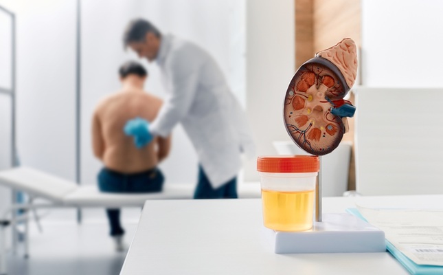 Imagen: la prueba de orina simple podría reducir el número de exámenes radiológicos a la mitad (foto cortesía de Shutterstock)