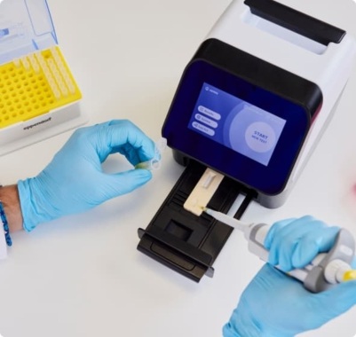 Imagen: según el acuerdo, Werfen obtendrá acceso a los componentes del ensayo NU.Q® H3.1 NETs propiedad de Volition (foto cortesía de VolitionRx)