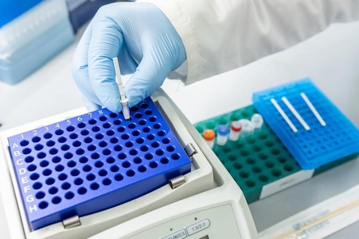 Imagen: el método basado en genética permite la detección precisa de TB a partir de hisopados linguales (foto cortesía de Kenny Lass/Universidad de Tulane)