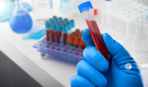 Imagen: nuevas moléculas de sangre pueden predecir con precisión los resultados de la presión arterial a largo plazo en adolescentes después de una cirugía bariátrica (fotografía cortesía de 123RF) Imagen: nuevas moléculas de sangre pueden predecir con precisión los resultados de la presión arterial a largo plazo en adolescentes después de una cirugía bariátrica (fotografía cortesía de 123RF)