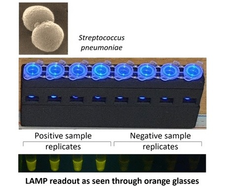 Imagen: el método simplificado basado en LAMP permite la detección POC de Streptococcus pneumoniae en entornos de bajos recursos (fotografía cortesía de ACS Omega, 2025; DOI: 10.1021/acsomega.5c01541)