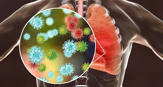 Imagen: una firma mínima de respuesta del huésped de cuatro genes detectada en la sangre puede excluir infecciones respiratorias bacterianas (fotografía cortesía de 123RF)