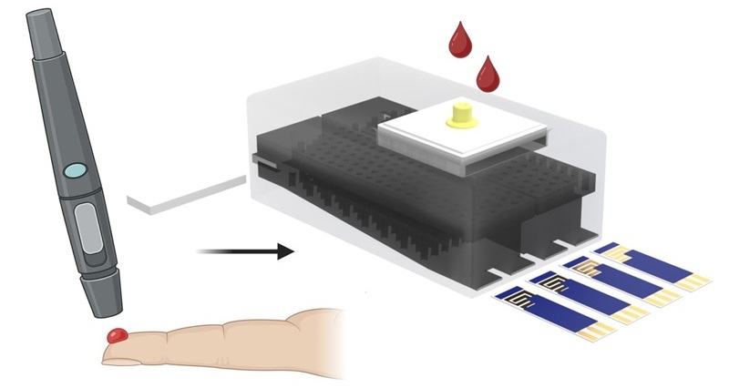 Imagen: el dispositivo de doble canal impreso en 3D separa firmas de proteínas y ARN para identificar de manera confiable la infección activa por VIH-1 (fotografía cortesía de Dipanjan Pan/Penn State)
