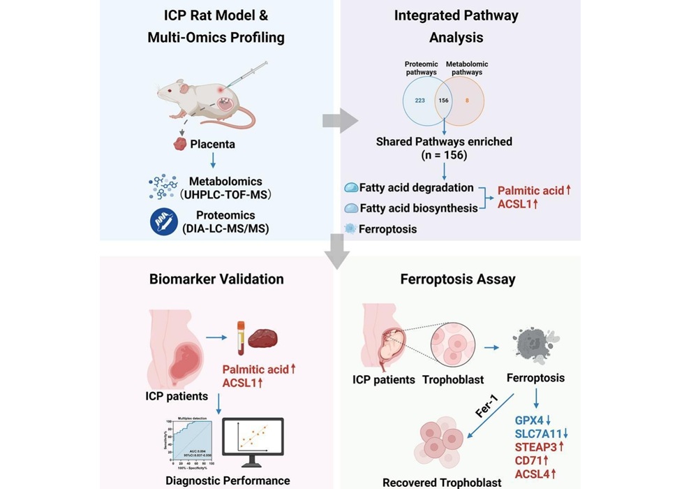 Imagen: el uso de ácido palmítico y ACSL1 junto con ácidos biliares podría mejorar el diagnóstico temprano de CIE (Ruirui Dong et al., Biochim Biophys Acta Mol Cell Biol Lipids (2025). https://doi.org/10.1016/j.bbalip.2025.159692)