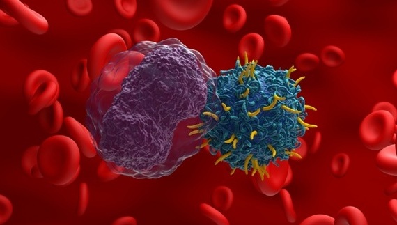 Imagen: el simple marcador sanguíneo puede predecir qué pacientes con linfoma se beneficiarán más de la terapia con células T CAR (fotografía cortesía de Shutterstock)