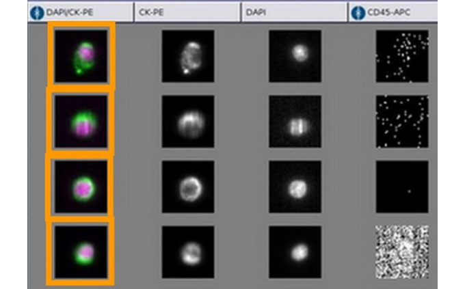 Imagen: el sistema CELLSEARCH utiliza una tecnología única para capturar, aislar y enumerar CTC (fotografía cortesía de Menarini)