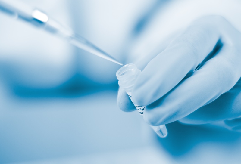 Imagen: el ensayo de investigación Simoa p-Tau 217 mide la tau fosforilada en sangre (fotografía cortesía de Quanterix)