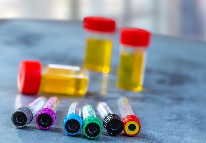 Imagen: la guía de expertos actualizada ayuda a los servicios de urgencias a alinear las pruebas de drogas en orina con las tendencias y tecnologías de medicamentos en evolución (fotografía cortesía de 123RF)