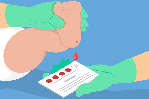 Imagen: el algoritmo de IA encuentra patrones en muestras de sangre de bebés prematuros que se correlacionan con su salud en etapas posteriores de la infancia (fotografía cortesía de 123RF)