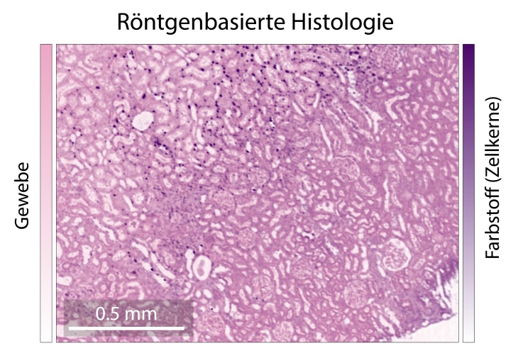 Imagen: los núcleos celulares están resaltados en violeta, mientras que el tejido restante se muestra en rosa: información valiosa para el diagnóstico (fotografía cortesía de Hereon/Dominik John)