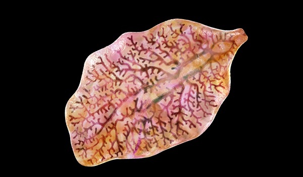 Imagen: la infección porduelas hepáticas chinos y del sudeste asiático es endémica en grandes regiones de Asia (fotografía cortesía de 123RF)