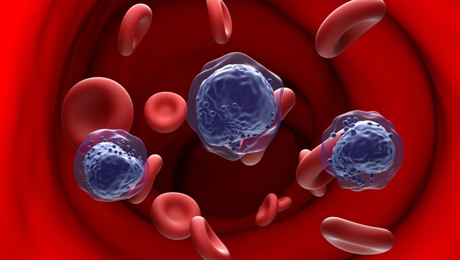 Imagen: AlloHome es una prueba de monitorización no invasiva basada en sangre, diseñada para predecir la recaída de la LMA y el SMD tras un trasplante alogénico de células hematopoyéticas (fotografía cortesía de Shutterstock)