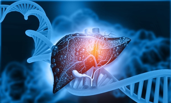 Imagen: los análisis de ADN libre de células basados ​​en sangre mediante IA detectan la fibrosis hepática temprana y otras enfermedades (Fotografía cortesía de Shutterstock)