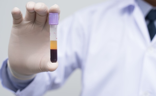 Imagen: el método perfila el material libre de células en el plasma para rastrear el origen de enfermedades a partir de tan solo 50 microlitros de plasma. (Fotografía cortesía de Adobe Stock)