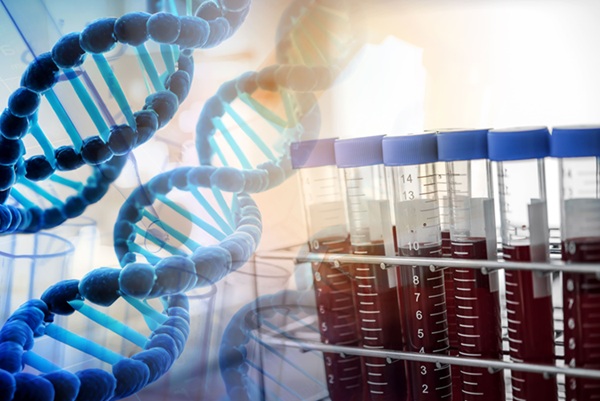 Imagen: el análisis del ctDNA en sangre puede identificar a las pacientes con cáncer de mama con baja probabilidad de responder únicamente a la terapia endocrina (fotografía cortesía de Adobe Stock)