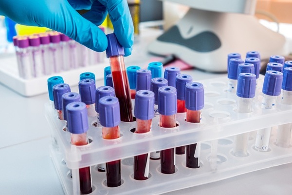 Imagen: el método perfila la metilación en ADN libre de células a partir de una sola muestra de sangre para detectar señales de enfermedades en todo el sistema (fotografía cortesía de Shutterstock)