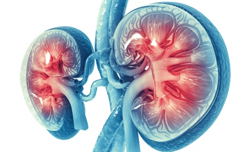 Imagen: un panel de plasma de nueve proteínas que estima la probabilidad de progresión de la enfermedad renal en personas con alto riesgo de APOL1 (crédito de la foto: Shutterstock)