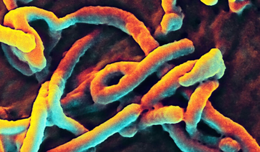 Imagen: Imagen coloreada de microscopía electrónica de barrido que muestra partículas del virus del Ébola brotando de la superficie de una célula (Fotografía cortesía del NIAID)