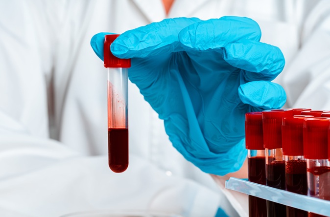 Imagen: los hallazgos muestran que las pruebas de ADNtc pueden ayudar a identificar candidatos para radioterapia y perfeccionar el tratamiento al señalar cuándo un cáncer ha cambiado o ha desarrollado resistencia (crédito de la imagen: 123RF)