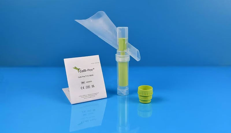 Imagen: Tras la autorización de la FDA, los proveedores pueden recetar el kit, lo que permite a los laboratorios procesar muestras de orina recolectadas en el hogar en plataformas automatizadas cobas (Fotografía cortesía de Orasure Technologies)