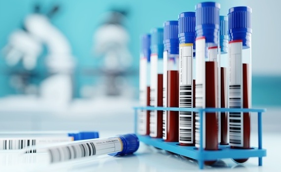 Imagen: Nuevos hallazgos muestran que los ARN circulares sanguíneos pueden predecir la progresión de la enfermedad de Alzheimer a corto plazo con mayor precisión que los marcadores establecidos (Crédito de la imagen: Adobe Stock)