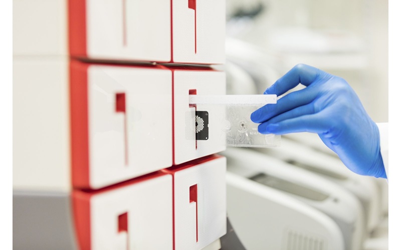 Imagen: Los paneles moleculares multiplex evalúan 22 y 11 objetivos, respectivamente, que abarcan bacterias, virus y parásitos de una sola muestra de heces, y los resultados están disponibles en aproximadamente una hora (Fotografía cortesía de bioMérieux).