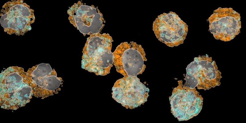  Esta imagen muestra granulocitos neutrófilos en diversas etapas de maduración en la sangre de un paciente que ha sufrido un infarto grave. La imagen fue captada mediante un microscopio de alta resolución. El núcleo celular aparece resaltado en gris, mientras que dos características típicas de la superficie de las células se destacan en naranja y turquesa. La célula precursora inmadura, conocida como preNeu, puede identificarse por su núcleo celular redondeado. (Foto cortesía de Mathis Richter)