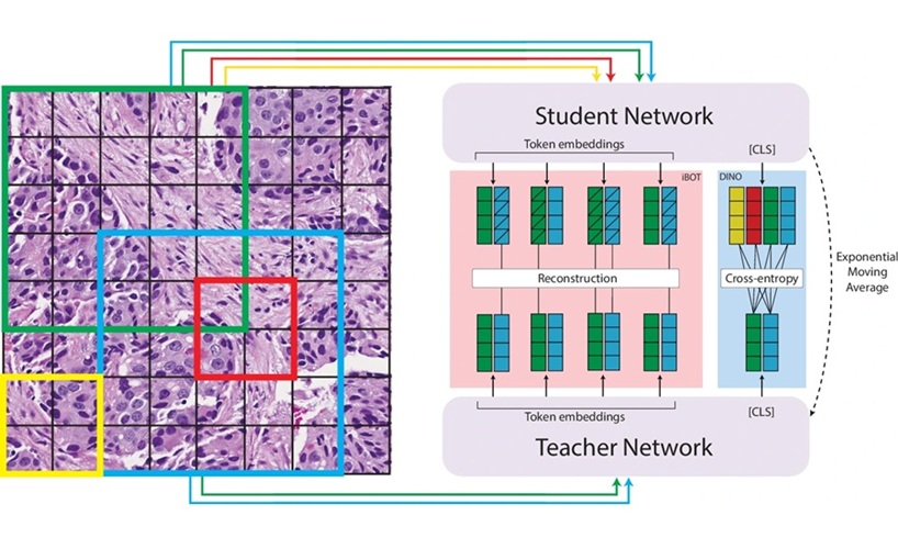 Imagen: Descripción general del método de aprendizaje autodirigido DINOv2 aplicado a la patología digital. (Witowski, J., Zeng, K.G., Cappadona, J. et al. Nature Communication, 2026. https://doi.org/10.1038/s41467-026-73088-y) Imagen: Descripción general del método de aprendizaje autodirigido DINOv2 aplicado a la patología digital. (Witowski, J., Zeng, K.G., Cappadona, J. et al. Nature Communication, 2026. https://doi.org/10.1038/s41467-026-73088-y)