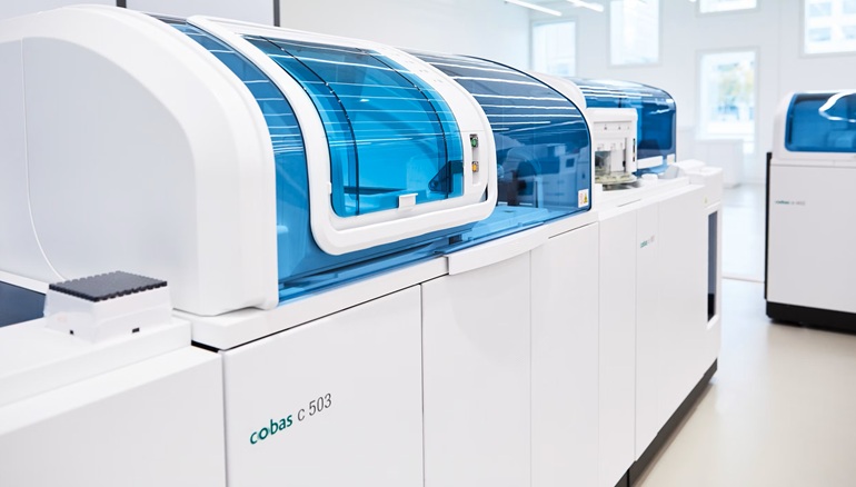 Imagen: Realizada en los sistemas de inmunoensayo cobas de Roche, la prueba ayuda a los laboratorios a satisfacer las crecientes necesidades de pruebas de tuberculosis mediante la automatización de los flujos de trabajo (Fotografía cortesía de Roche)