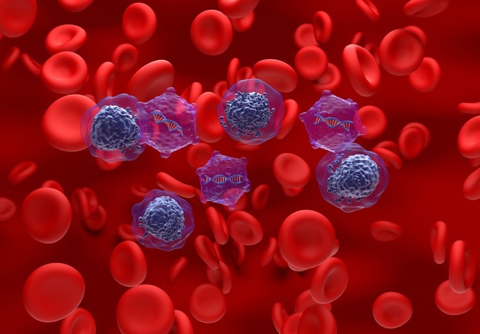 Imagen: Los hallazgos muestran que los análisis epigenéticos pueden dividir la leucemia en subgrupos biológicamente relevantes, proporcionando más información que la genética sola (Crédito de la imagen: iStock)