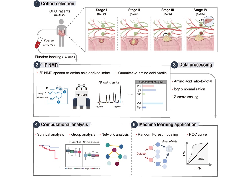 Imagen: Flujo de trabajo para el perfilado de aminoácidos séricos y el análisis de datos mediante RMN de ¹⁹F. Las muestras de suero obtenidas de pacientes con cáncer colorrectal (CCR) se sometieron a un proceso de detección de aminoácidos basado en el marcaje con flúor, seguido de espectroscopia de RMN de ¹⁹F. Los datos cuantitativos de los aminoácidos se procesaron utilizando normalización basada en ratios y análisis multivariantes para caracterizar patrones metabólicos específicos de cada estadio y desarrollar modelos de aprendizaje automático destinados a la predicción del riesgo pronóstico. (Foto cortesía de KAIST) Imagen: Flujo de trabajo para el perfilado de aminoácidos séricos y el análisis de datos mediante RMN de ¹⁹F. Las muestras de suero obtenidas de pacientes con cáncer colorrectal (CCR) se sometieron a un proceso de detección de aminoácidos basado en el marcaje con flúor, seguido de espectroscopia de RMN de ¹⁹F. Los datos cuantitativos de los aminoácidos se procesaron utilizando normalización basada en ratios y análisis multivariantes para caracterizar patrones metabólicos específicos de cada estadio y desarrollar modelos de aprendizaje automático destinados a la predicción del riesgo pronóstico. (Foto cortesía de KAIST)