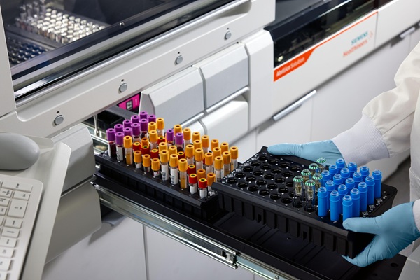 Imagen: Las pruebas capilares en los analizadores Atellica respaldan las necesidades de pruebas de laboratorio más comunes (Fotografía cortesía de Siemens Healthineers)