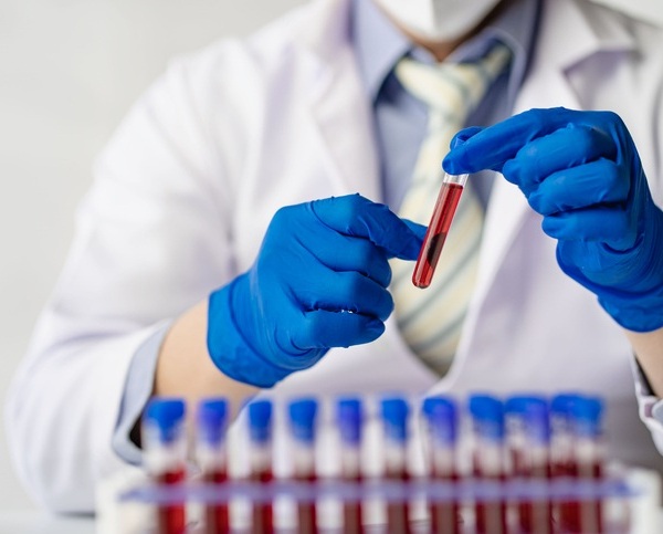 Imagen: Nuevos hallazgos muestran que medir un panel más amplio de proteínas sanguíneas puede mejorar la estadificación de la enfermedad de Alzheimer (Crédito de la imagen: iStock)